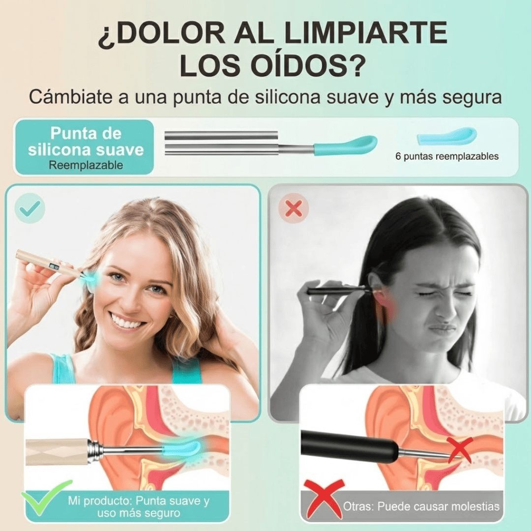Limpieza de Oídos con Cámara HD