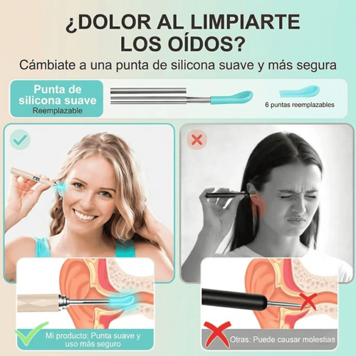 Limpieza de Oídos con Cámara HD