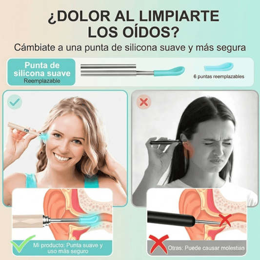 Limpieza de Oídos con Cámara HD